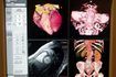 CT-Scan et l'IRM du cœur humain et la moelle épinière
