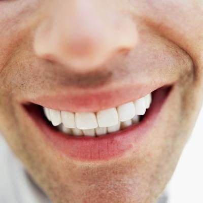 Couronnes peuvent être utilisés pour protéger une dent faible de rupture.