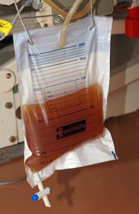 Patient's urine.