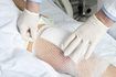 Les soins post-opératoire d'une chirurgie de remplacement du genou.