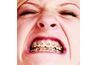 dents étant redressés