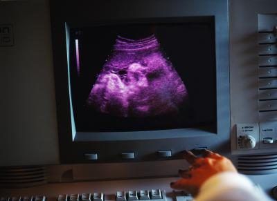 Foetus à l'échographie