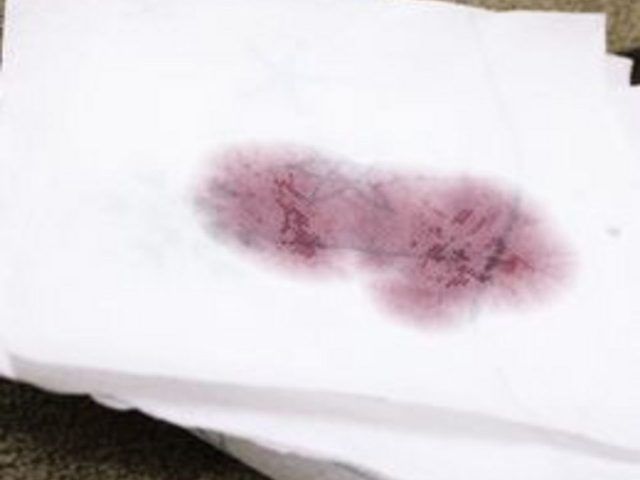 Comment faire pour supprimer les taches de vin rouge d'un tapis