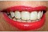 Des dents blanches sourire!