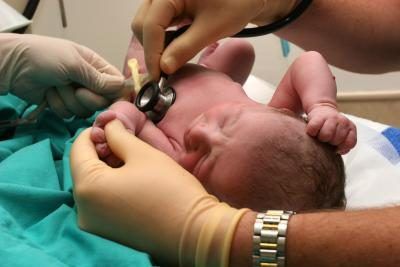 Les infirmières examinent un bébé après la naissance.