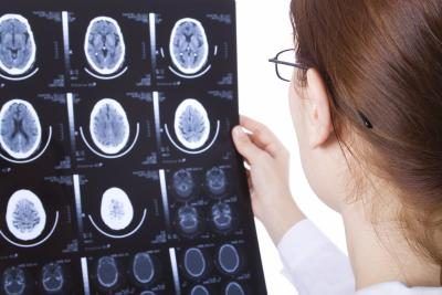 Un médecin regardant radiographies cerveau.