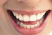 Les implants dentaires offrent un meilleur aspect cosmétique.