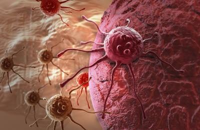 Illustration de cellules cancéreuses.