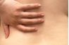 La sciatique est associée à des douleurs dans le bas du dos.
