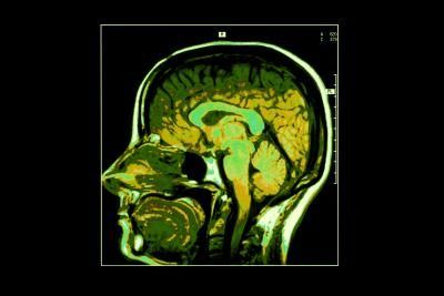 Image de section transversale du cerveau humain