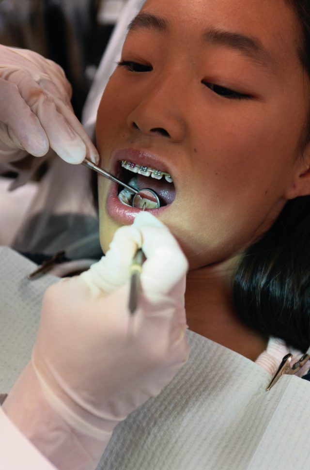 Les services d'orthodontie peuvent varier un peu