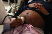 FDA évalue l'intensité des ondes ultrasonores pour assurer la sécurité du fœtus.