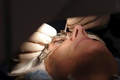 La chirurgie est la forme la plus commune et la réussite du traitement de la cataracte, la preuve d'un succès dans environ 98% des cas.