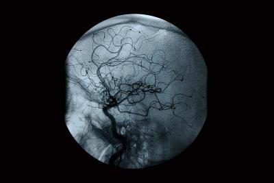 Image de rayons X d'un système circulatoire