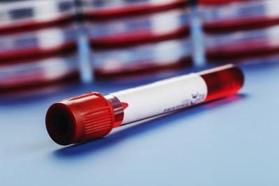 Des tests sanguins peuvent vérifier les protéines de la thyroïde.