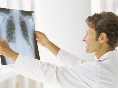 Docteur regardant une radiographie de la poitrine