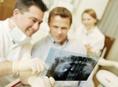 Une fois que vous avez discuté de votre décision avec votre dentiste, il obtiendra des rayons X de vos dents.