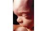 Foetus réelle à vingt semaines de gestation.