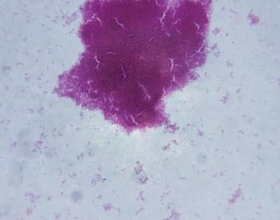 Image microscopique de bactéries.