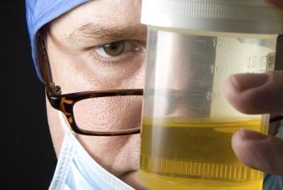 Il est essentiel à la réussite d'un test d'urine que l'échantillon soit correctement stocké avant le test.