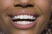 conditions de la thyroïde peuvent conduire à la carie dentaire.