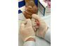 Tests de glycémie comprend un échantillon de sang prélevé soit le bras ou un doigt.